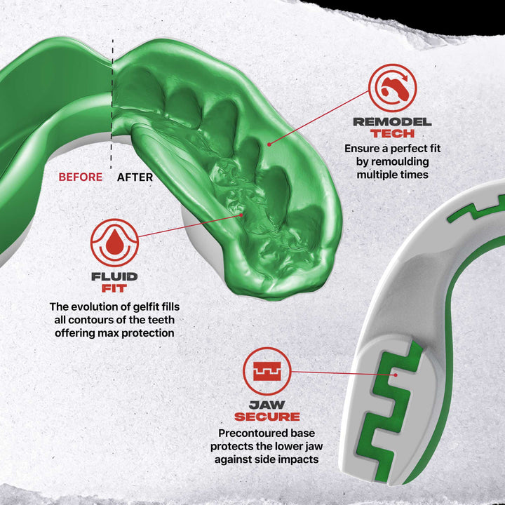 SafeJawz Extro Flags Range Mouthguard Italy
