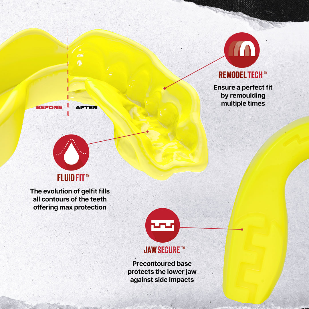 SAFEJAWZ® Intro Series Mouthguard - Fluro Yellow