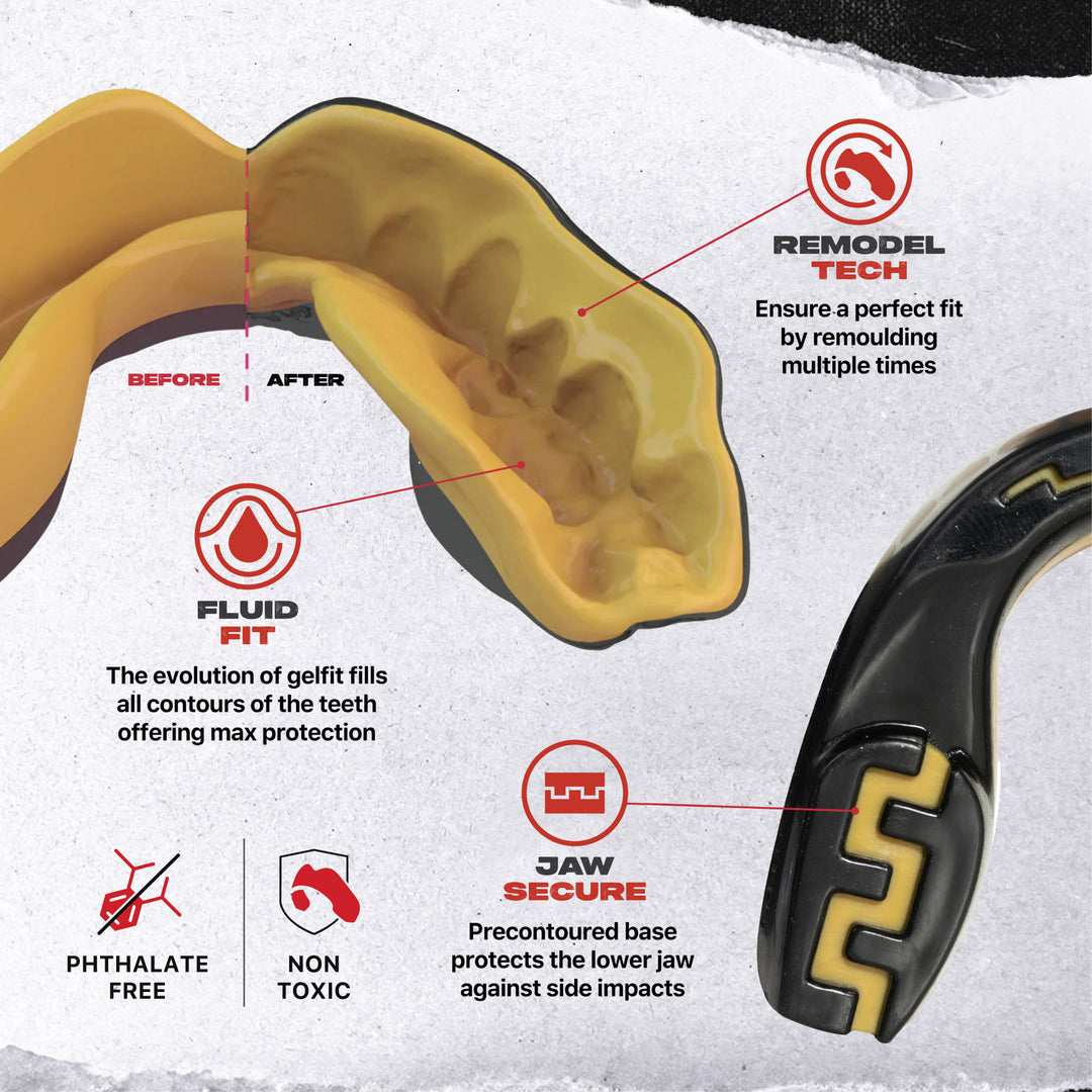 SAFEJAWZ® 'Goldie' Mouthguard - Extro SEries - Black & Gold