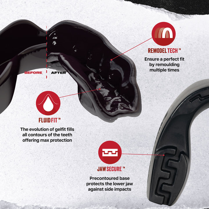 SAFEJAWZ® Intro Series Mouthguard - Black