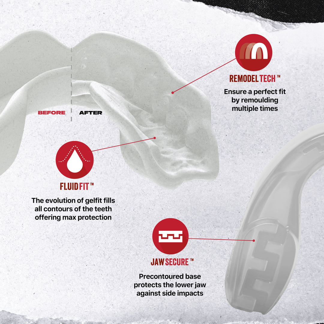 SAFEJAWZ® Intro Series Mouthguard - Clear