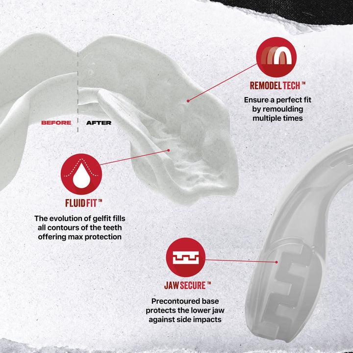 SAFEJAWZ® Intro Series Mouthguard - Clear