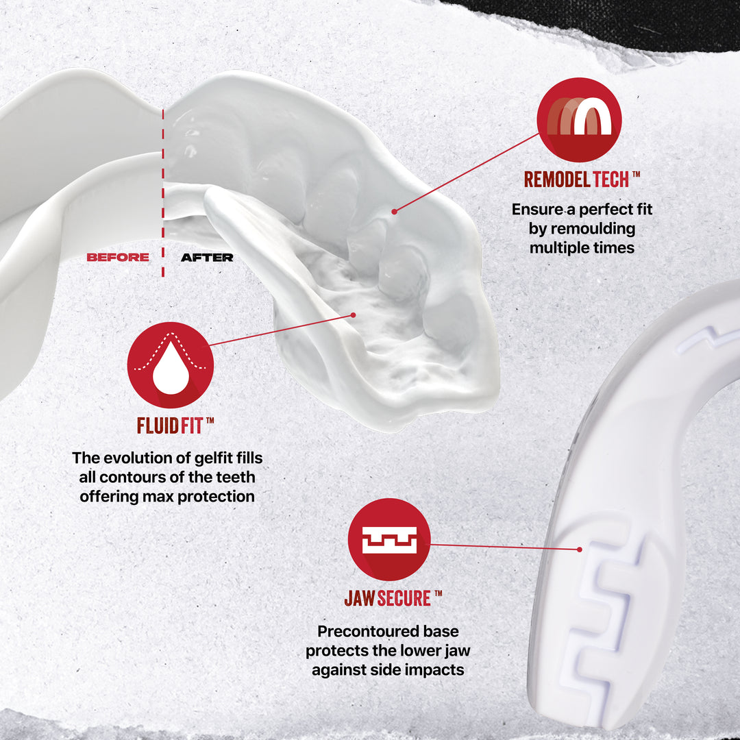 SAFEJAWZ® Intro Series Mouthguard - White