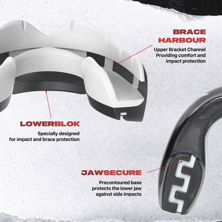 SAFEJAWZ® 'Fangz' Mouthguard for Braces.