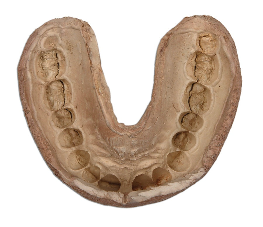 The history of sports mouthguards