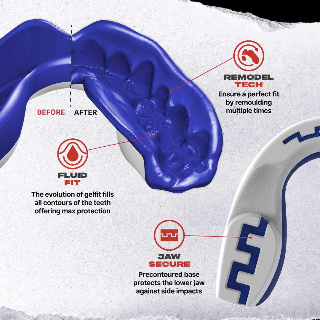 SafeJawz Extro Flags Range Mouthguard France