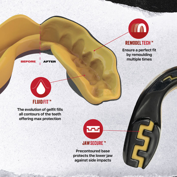 SAFEJAWZ® 'Goldie' Mouthguard - Extro SEries - Black & Gold