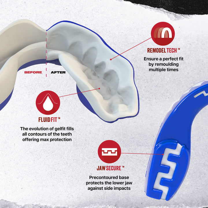 SAFEJAWZ® 'Shark' Mouthguard - Extro SEries - Blue & White