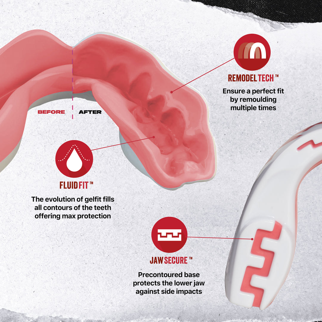 SAFEJAWZ® 'Pink Fangz' Mouthguard - Extro - White & Pink