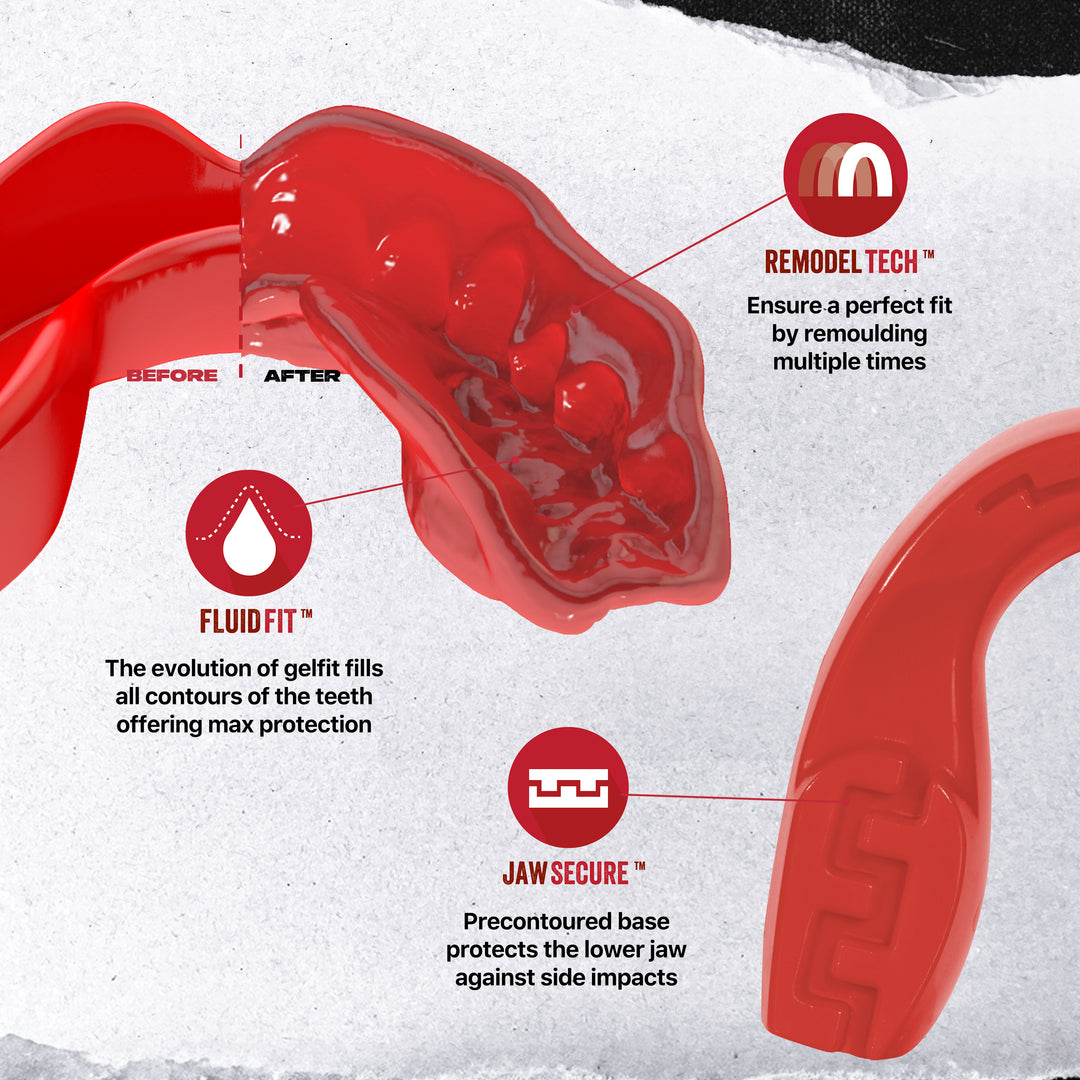 SAFEJAWZ Intro Series Mouthguard Bundle – Red
