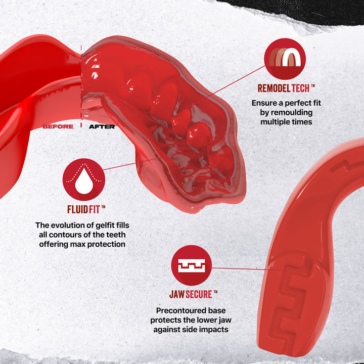 SAFEJAWZ Intro Series Mouthguard Bundle – Red