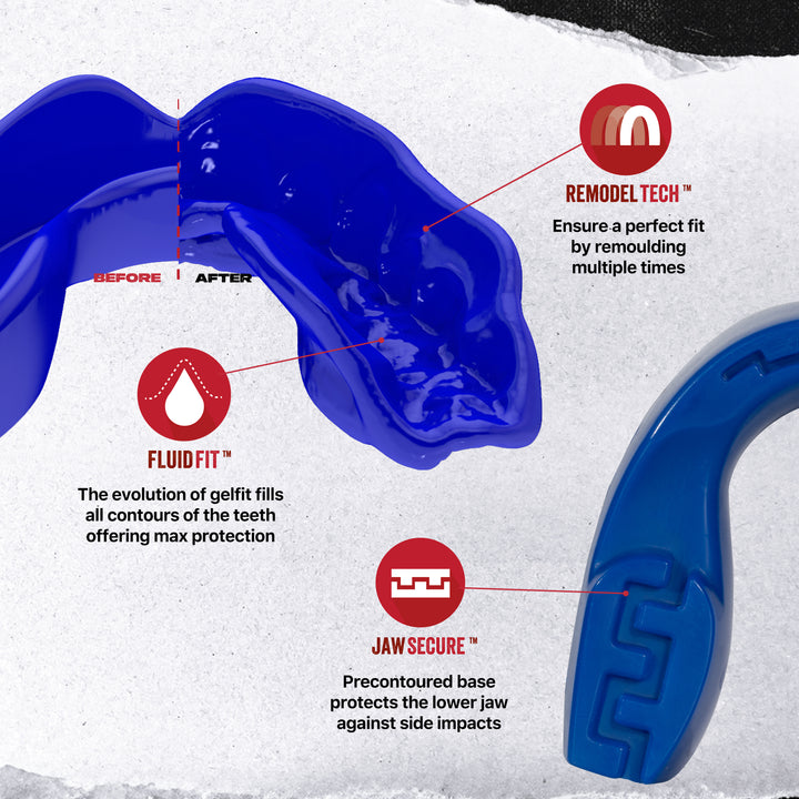 SAFEJAWZ Intro Series Mouthguard Bundle – Blue
