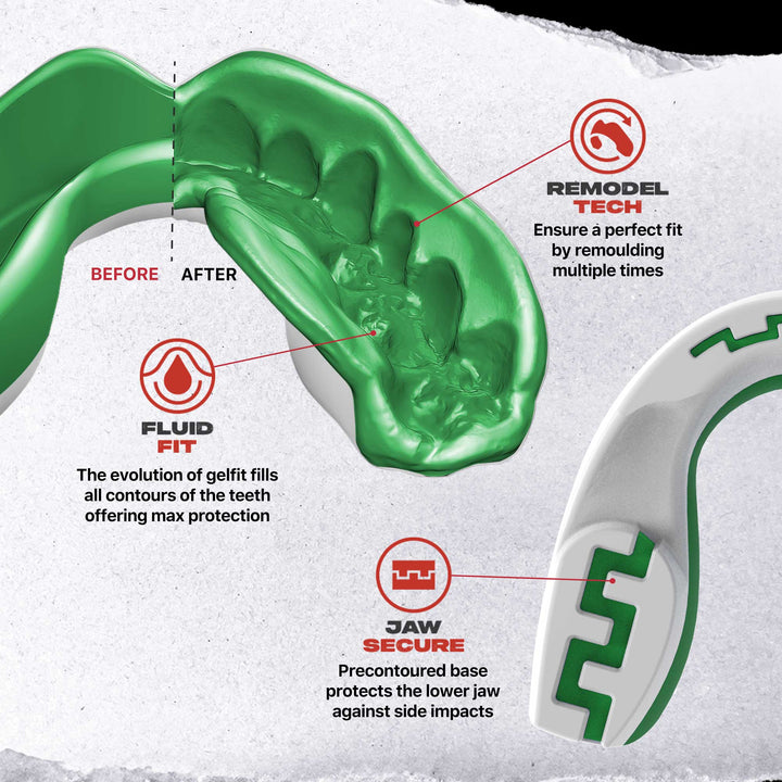 SafeJawz Extro Flags Range Mouthguard Ireland