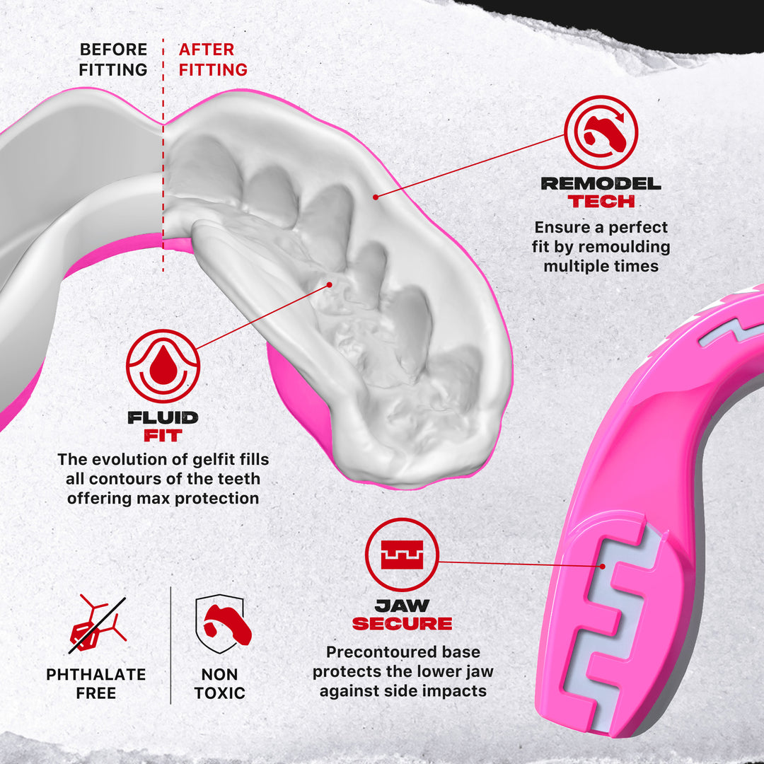 SAFEJAWZ Extro Series Pink Viper Mouthguard