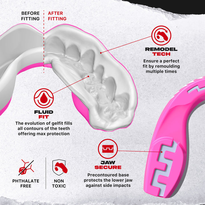 SAFEJAWZ Extro Series Pink Viper Mouthguard