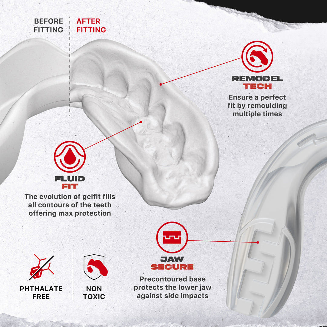 SAFEJAWZ Extro Series Premium Bundle - Clear Fangz
