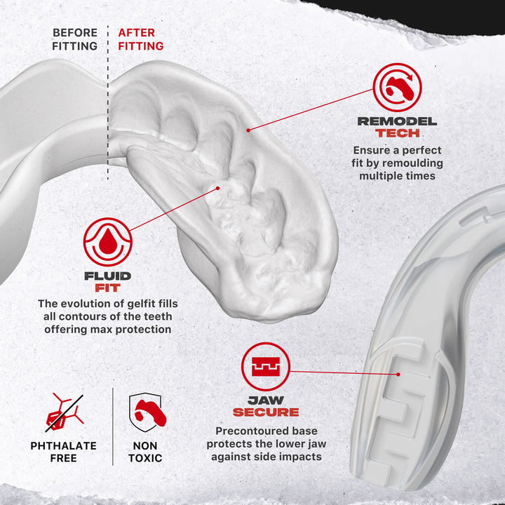 SAFEJAWZ Extro Series Premium Bundle - Clear Fangz